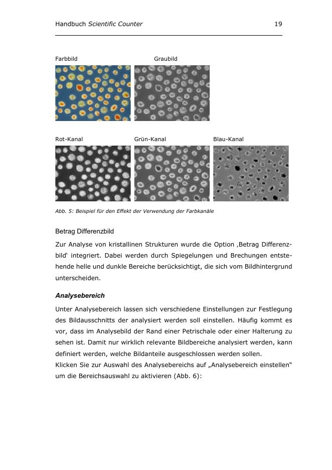 Beispiel Farbkanäle und Differenzbild im Scientific Counter